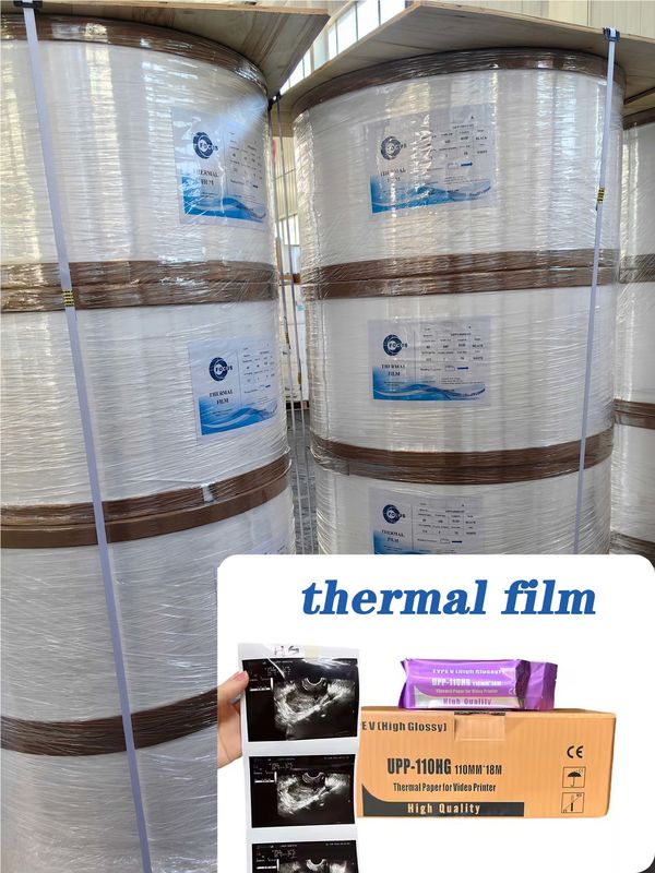 Eco-Friendly Thermal Print Media Recyclable Ultrasound Paper Film for Packaging Labels Bulk Film Rolls in 75um 95um
